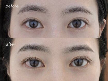 ネストアイ(NEST eye)の写真