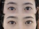 ネストアイ(NEST eye)の写真