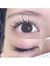 ビーティー(bT)/