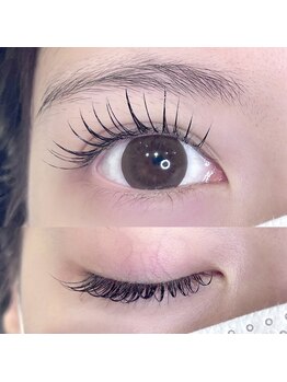 ビーティー(bT)/