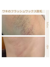 オフオルファヴォリ(OF Olu:Favori)/【フラッシュワックス脱毛】