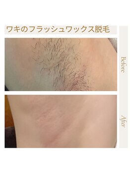 オフオルファヴォリ(OF Olu:Favori)/【フラッシュワックス脱毛】