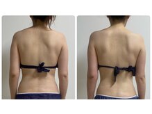 エヌラボ(N.LABO)/肩甲骨はがし/ブライダル痩身