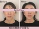 ベルフルール(Belle Fleur)の写真