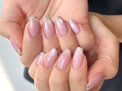 ブレスネイル(brace Nail)の写真