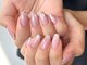ブレスネイル(brace Nail)の写真