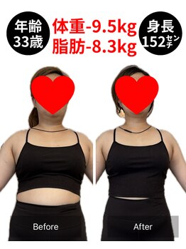 アネモネ/ダイエット/痩身/耳つぼ/腸活