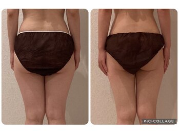 ボーテ(beaute)/【骨盤ケア】