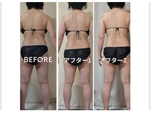 ひぺりかむ/【ステップエステ】ひぺりかむ