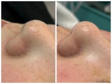 フェリーチェ 海老名(Felice)/フェイシャルBA