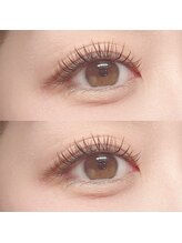 フーフロー(Fooflow)/フラットラッシュ140本