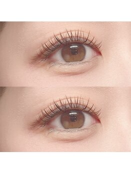 フーフロー(Fooflow)/フラットラッシュ140本