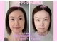 ラ キュート(LA-9TE)の写真