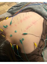 リム(Rim.)/疲れが取れないそんなお悩みに！