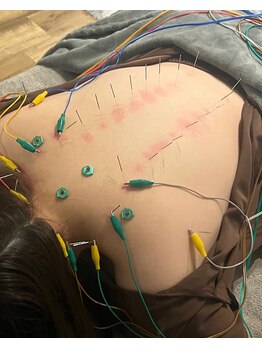 リム(Rim.)/疲れが取れないそんなお悩みに！