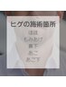 【男性】ヒゲ脱毛