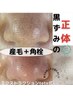 お久しぶりな方も★再来キャンペーン★毛穴綺麗美白コース¥12000→¥9900