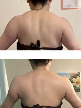 ルアナ(LUANA)/二の腕・背中の贅肉も徹底ケア！