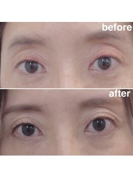 サラ デ ミレ(Sala de milae)/骨格似合わせ眉毛＆まつ毛パーマ