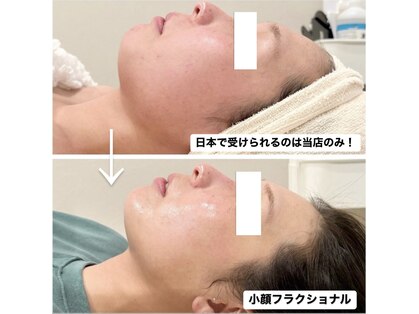 オルネ(ORNE.)の写真