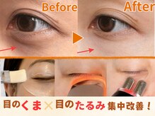 プライベートサロン レイ(Ray)の雰囲気（くま・目のたるみに集中ケア！明るく引き締まった目元へ）