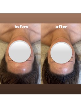 &still【アンドスティル】【4/1 NEW OPEN(予定)】 /【小顔コルギ】