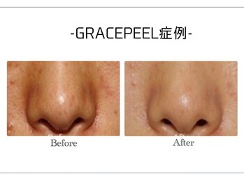 韓国肌管理・白玉肌管理 HOPE Retailer 安城店【3月OPEN(予定)】/施術写真