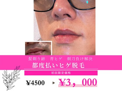 スムース イー(Smooth+E)の写真