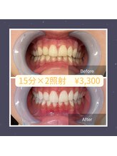 ベルプラス 新大阪(Belle plus)/Belle plus ホワイトニング