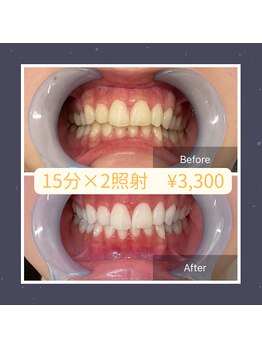 ベルプラス 新大阪(Belle plus)/Belle plus ホワイトニング