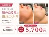 【山口限定】首肩コリ解消！顔のたるみ引き上げUP強圧コルギ　60分6300→5700