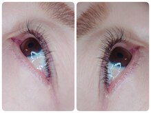 アポストロフィエス/フラットラッシュ140本