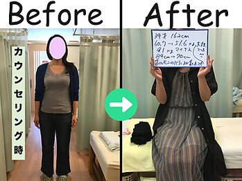 杉本接骨鍼灸院/ 【ダイエット】34歳　9.1キロ