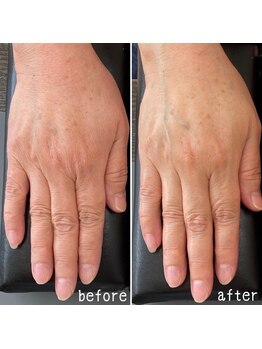 ネイルズ アヴァンティ(Nails Avanti)/美手肌エステ