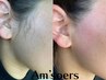 【１ヶ月以内の再来】【男女】ワックス脱毛≪全顔≫