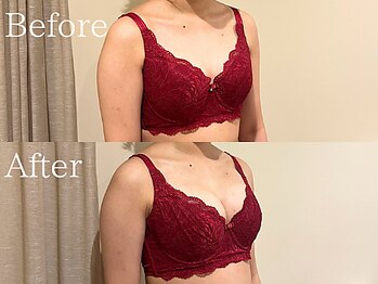 ナリッシュ バスト 六本木(Nouriche Bust)/バストアップ◇ビフォーアフター