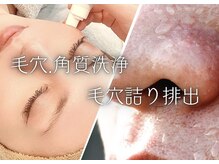 香嬉琉/毛穴レス肌に