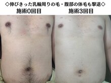 ヒカリ 淡路店(HIKARI)