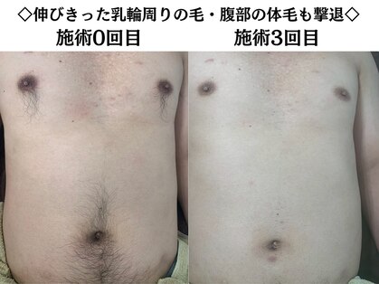 ヒカリ 淡路店(HIKARI)の写真