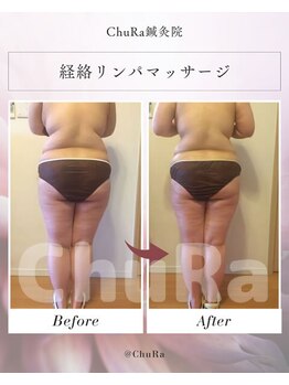 チュラ鍼灸院 西宮北口(ChuRa鍼灸院)/体重・年齢制限なし