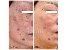 ルナ(Luna)の雰囲気（60代でもここまで変化）