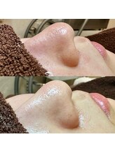 エクラ バイ シャンリィ(eclat by shanLy)/油詰まり改善！