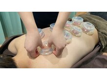 足のトラブルセンター 新札幌店/人気の吸い玉もございます☆