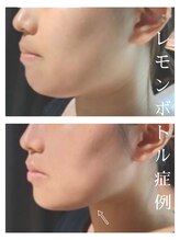 カピリナスパ(Ka.Pilina Spa) レモン ボトル