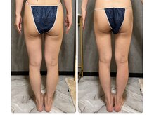 フュース(Futh)/２回の効果♪ヒップアップ