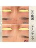 【40～50代の方へ】ハーブピーリング／REVI +リキッド付¥16,500→¥11,000