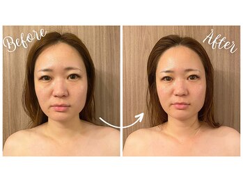 アプリフト(Uplift)