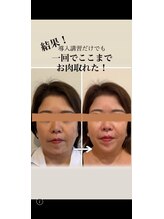 ルミナス/お顔ハッピーコース