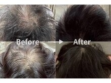 ミノオビュートガーデン(MINOH BEAUT garden)/