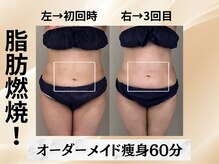 イヨヨ(iyoyo)/【痩身】Before After